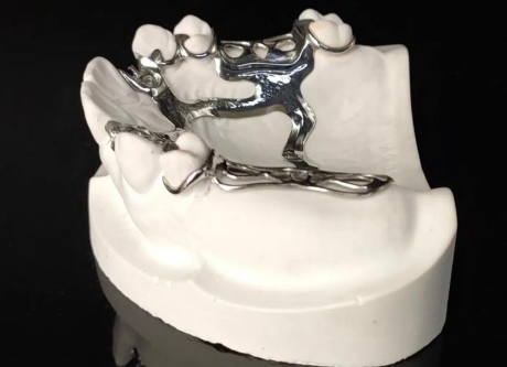 三、缺牙不补一般几年邻牙会掉?如何预防邻牙问题的发生