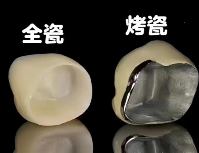 泽康全烤瓷牙多少钱一颗价格？美维1280元VS华美1580元，技术差异揭秘200元差价！