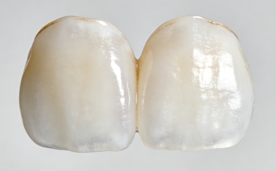 二、美嘉贴面的技术实力与行业认可