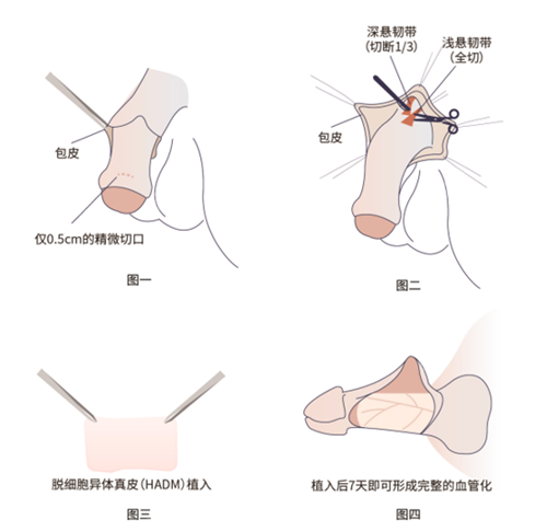 三、关于包装照片的注意事项