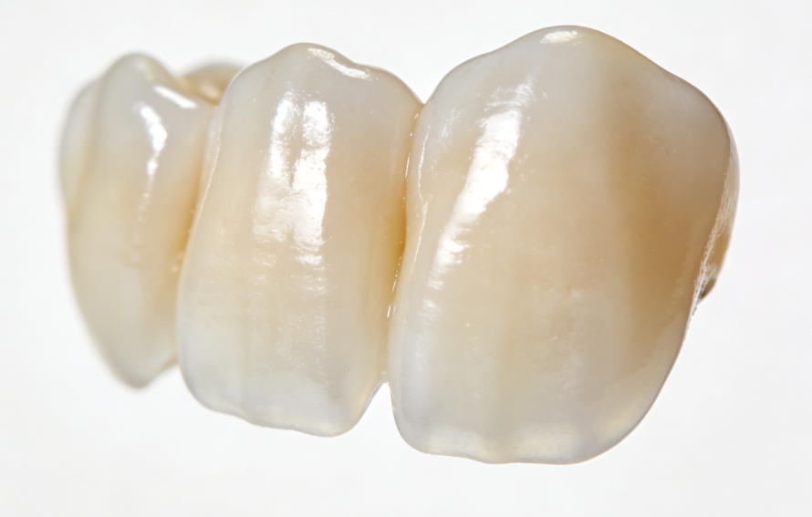 吉尔巴赫多少钱一颗？价格大概在2800到8000元之间