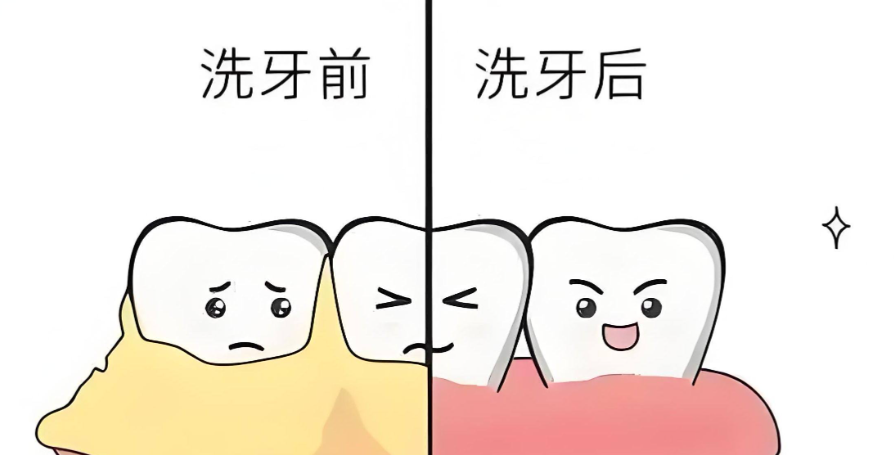 八、总结:梅州医院洗牙多少钱?