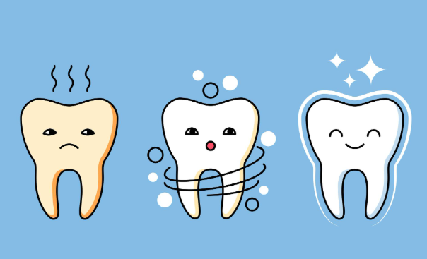 徐州美白牙齿大概多少钱，冷光美白3000起，贴面6000起