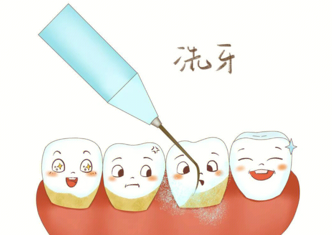 三、常德哪里洗牙多少钱?成人超声波洗牙+抛光价格区间