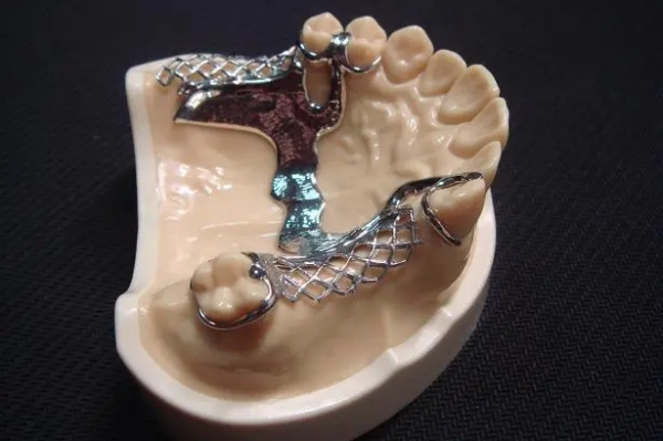 爱尔创义齿和麦迪哪个好？2026年用户反馈：爱尔创略胜一筹，细节处理更用心