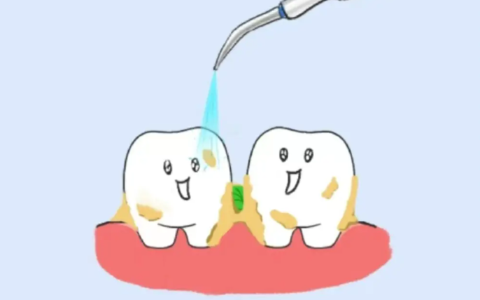 七、洗牙后额外费用