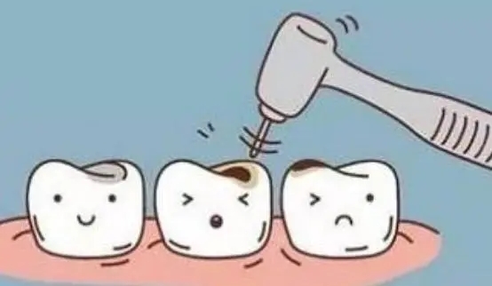六、儿童补牙专项修复价格