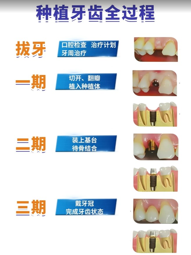 二、价格差异背后的原因