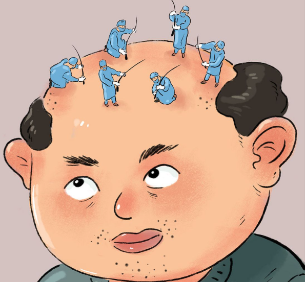 二、影响植发价格的主要因素