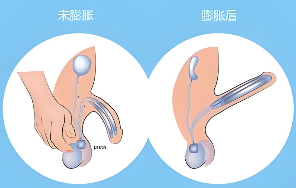 二、玻璃的使用寿命：不同场景下的表现差异