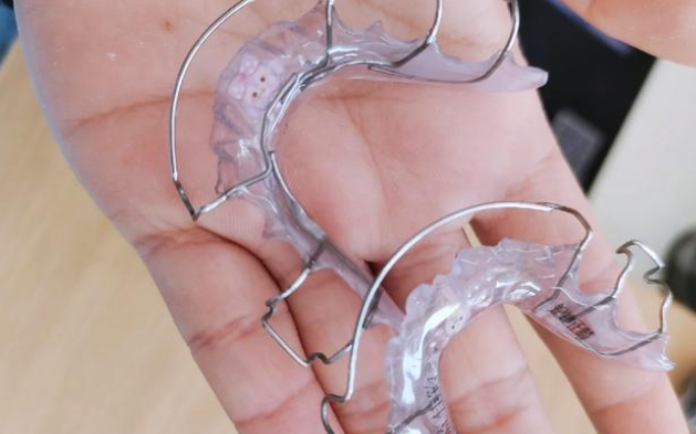 三、保持器类型选择与佩戴技巧