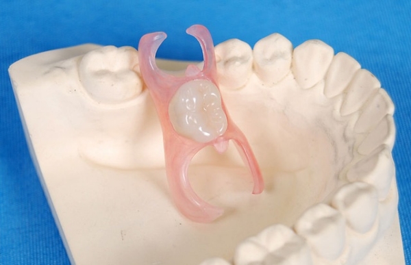 牙槽骨植骨多久可以做义齿矫正？术后3-6个月黄金期，2026最新研究揭秘关键数据！