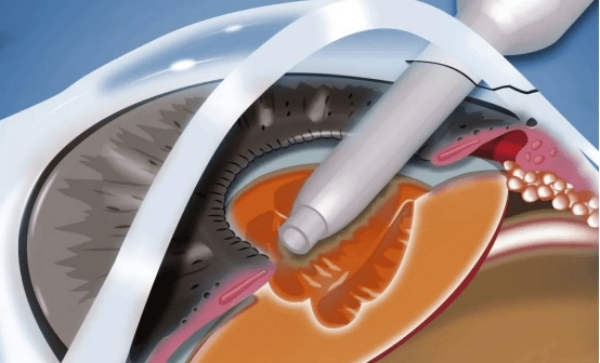 牙釉质有再生功能吗？2026年最新研究：人工修复技术突破让牙釉质能重新长出来！