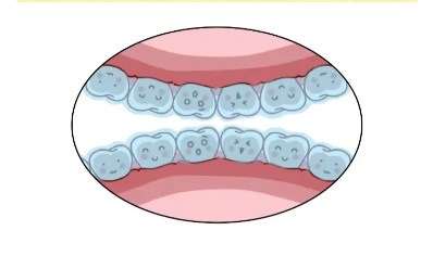二、正雅隐形矫正S8系列的适应症与适用人群