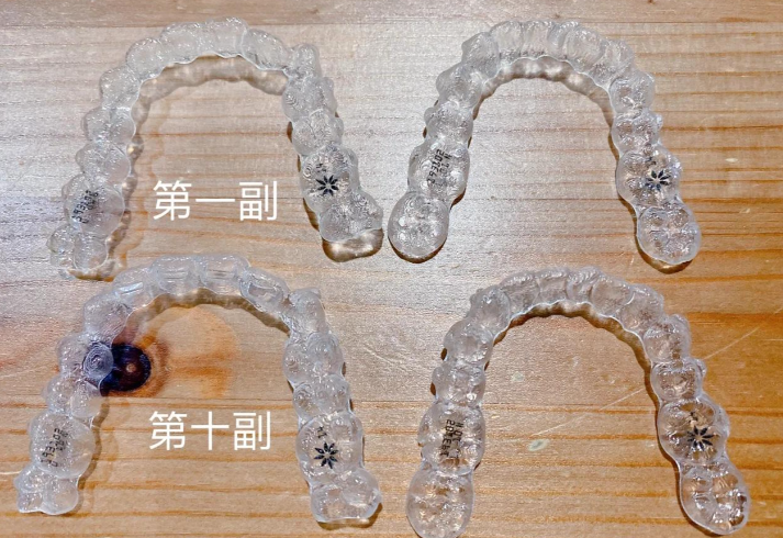 二、隐适美矫正过程的视觉呈现与疗效追踪