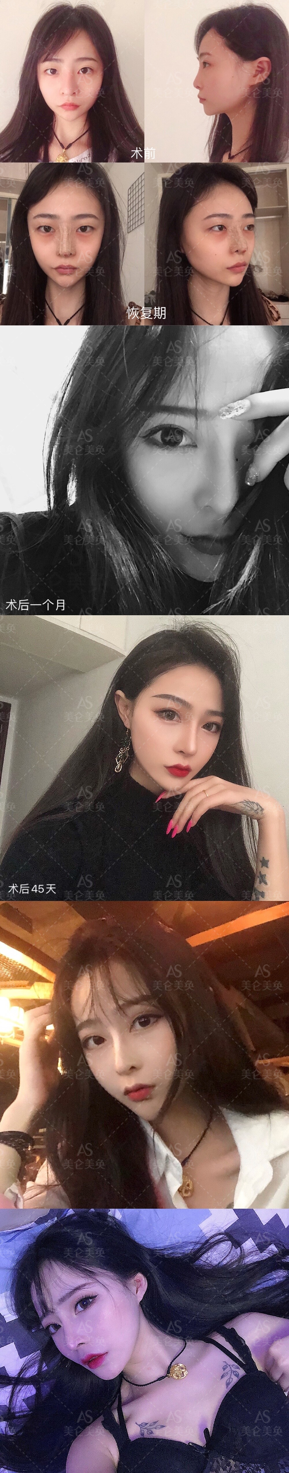 七、重庆美仑美奂整形美容医院