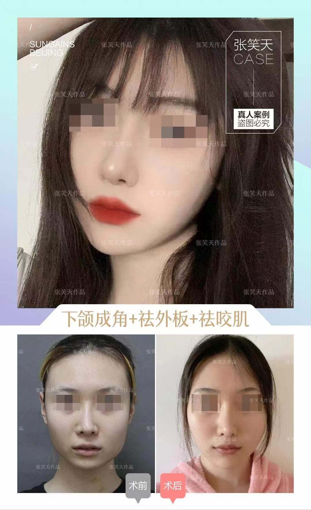 四、北京圣嘉新医疗美容医院