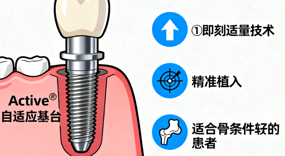三、如何选择适合自己的种植体系列