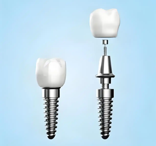 三、2026年登腾种植体参数大全：官方图谱与临床应用对照表