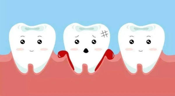 三、350树脂与其他补牙材料价格对比