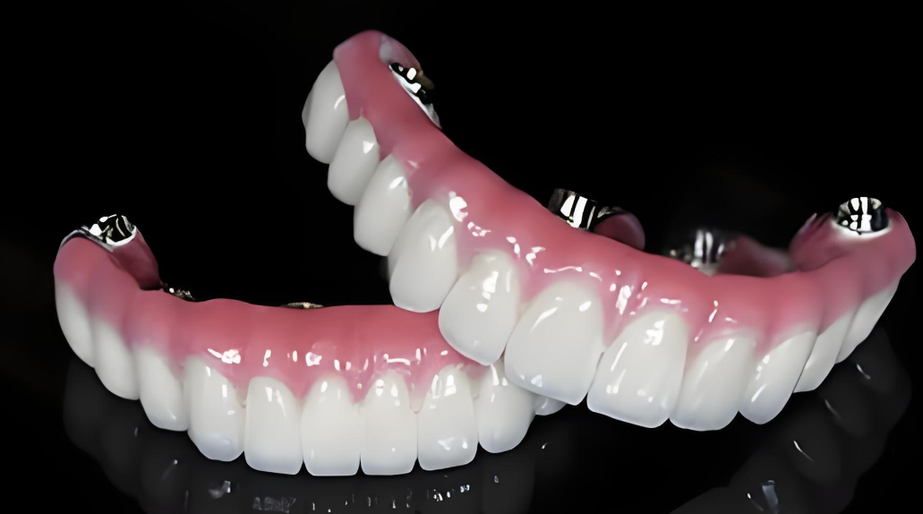 马龙桥架是进口的吗？上海本地用户揭秘国产优质材质与价格对比全公开！