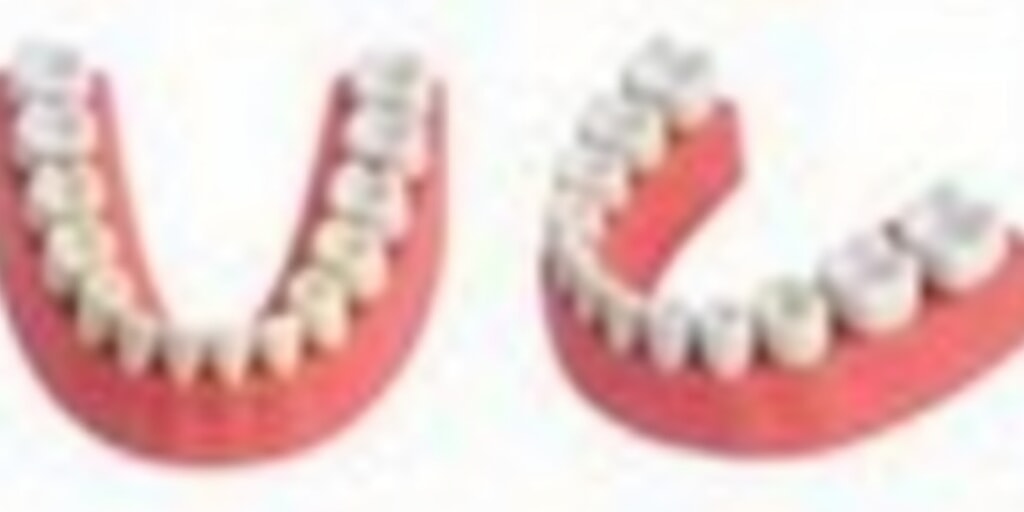 二、影响二次粘接强度的关键因素