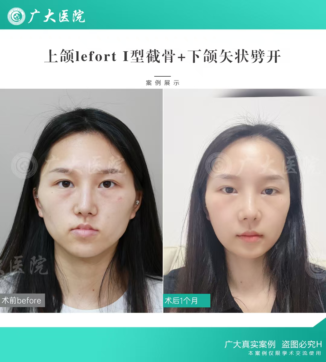 四、广州广大口腔官网用户评价与口碑分析