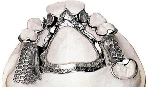 过渡性义齿怎么安装？3步搞定+安装后注意事项全解析！