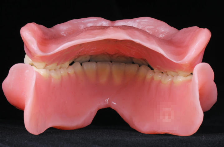 北京吸附性义齿医院排名TOP3揭秘！2026年吸附性义齿价格区间+材料类型全解析