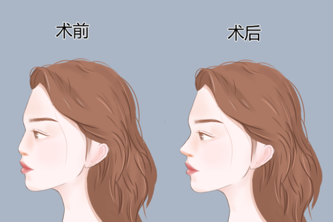 二、张家口露茜娅医疗整形项目价格解析与市场对比