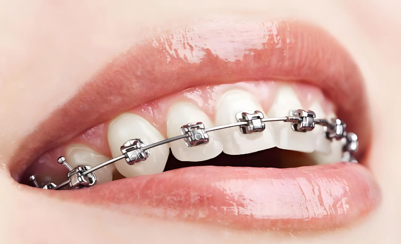 三、常见误区与科学应对方法