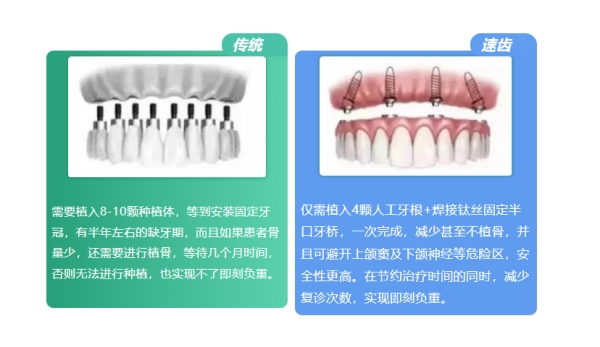 三、关于种植牙,临海朋友们较关心的几个问题